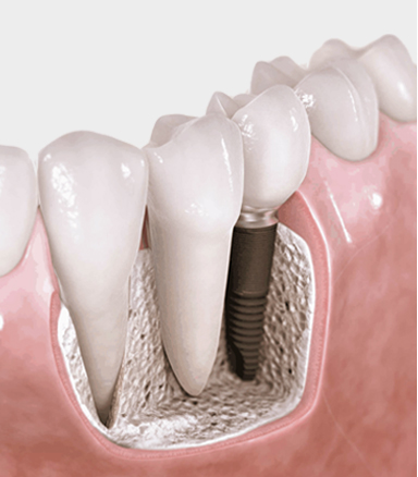 盐城市艾美莱口腔医疗有限公司