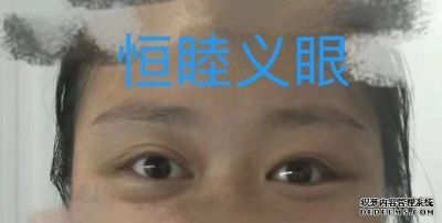 广东深圳市恒睦义眼医疗器材康复辅助有限公司